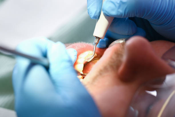 Best Emergency Treatment for Oral Infections in Knightstown, IN