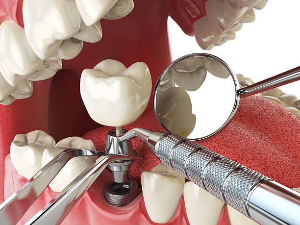 Best Walk-In Emergency Dental Services in Knightstown, IN